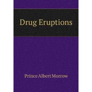  Drug Eruptions: Prince Albert Morrow: Books