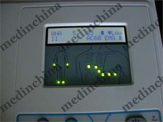   of 12 lead ecg signal manual auto arrhythmia analysis modes