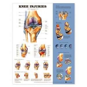 Knee Injuries Anatomical Chart Unmounted 9872PU:  