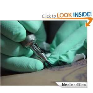 Tattoo Removal Options and Alternatives Willbey Inkless  