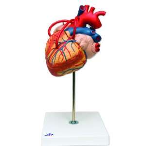 3B Scientific G06 4 Part Heart with Bypass Model, 2 Times Life Size, 7 
